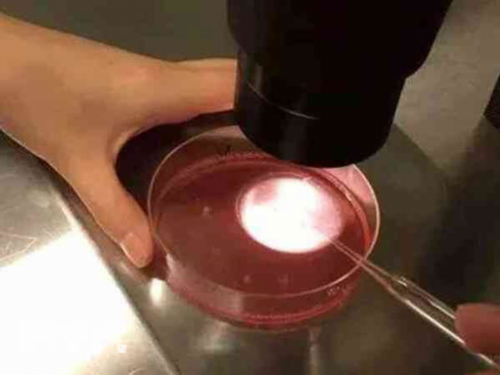 新生儿多指畸形好的手术时间