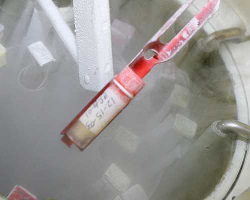 捐卵公司：试管促排卵需要多少时间，浅谈促排卵的作用及时间安排