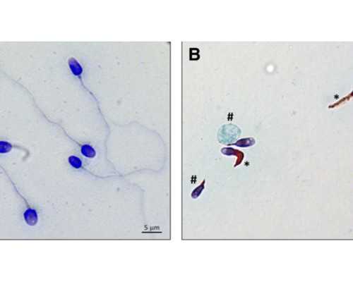 温州附二医试管婴儿(温州附二医试管婴儿)