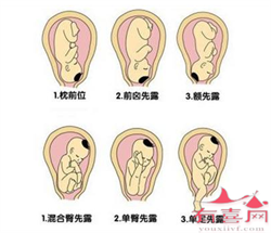 浙江供卵志愿者，浙江温州有哪些可以申请供卵做试管婴儿的医院？